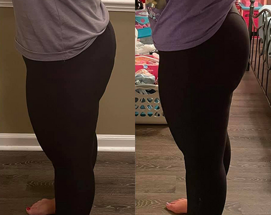 Db Method Before And After Pictures